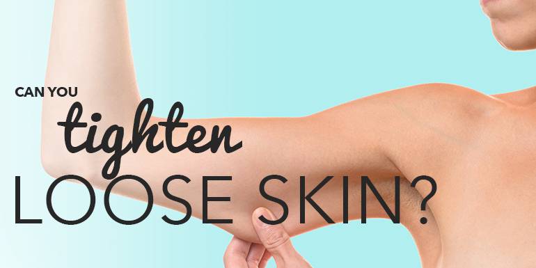 Can You Tighten Loose Skin After Losing Weight?