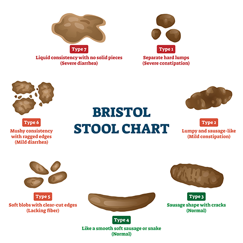 Bristol Stool Chart graphic