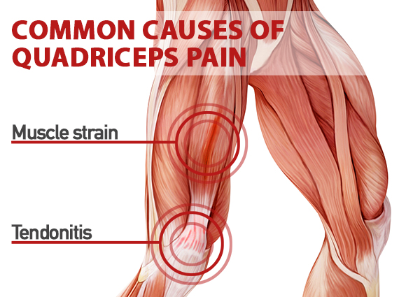 Quad Muscles Everything You Need to Know BODi