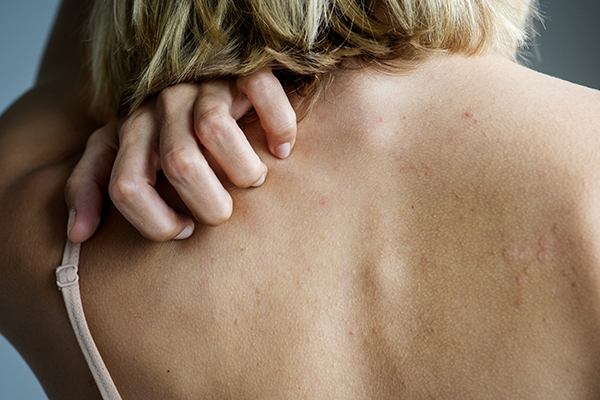 Woman scratching her back over her shoulder