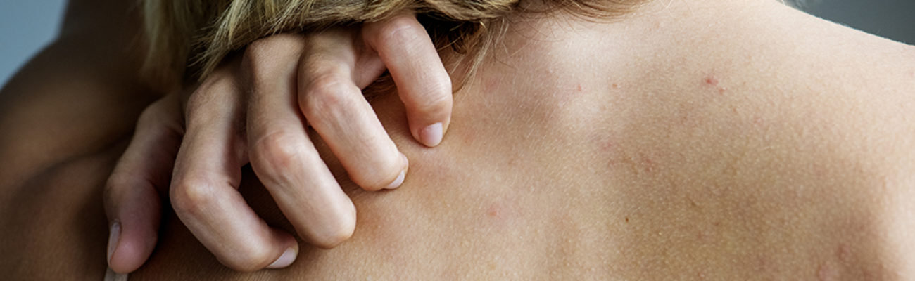 Woman scratching her back over her shoulder