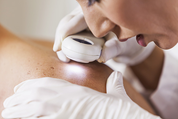 Dermatologist examining patient skin