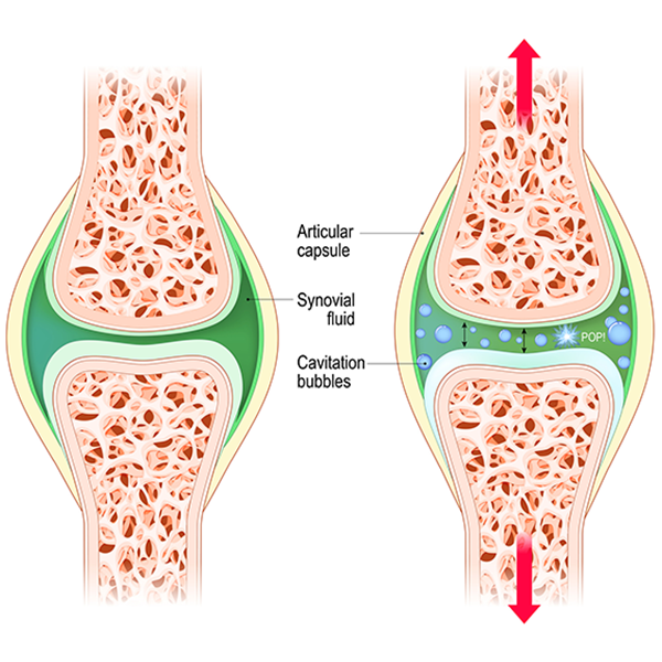 Why Your Joints Crack and What to Do About It