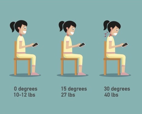 Graphic of Severity Levels | Nerd Neck