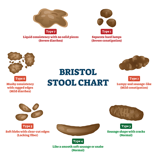 Bristol's Chart drawing with drawn images | Poop Health: