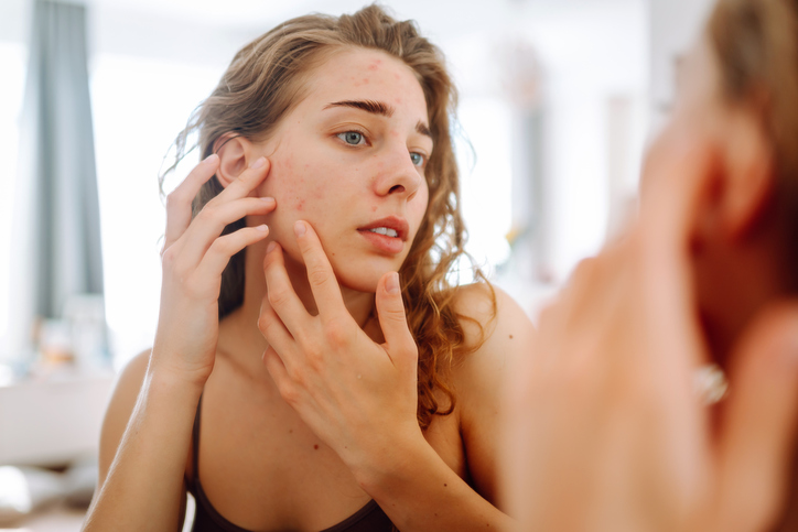 woman checking skin in mirror